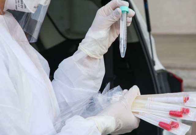 Barueri e Parnaíba recebem kits de testagem para novo coronavírus