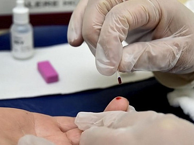 Casos de hepatite A aumentam 54,5% em 2024 no Brasil, segundo MS