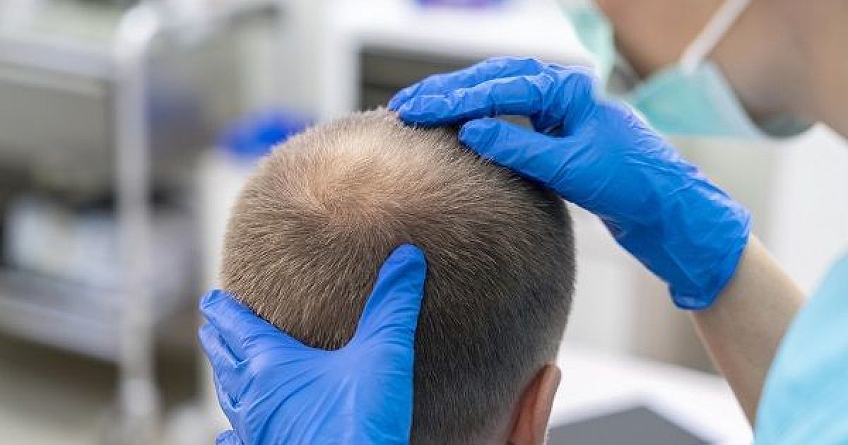 Alphaville vai abrigar o primeiro hospital do mundo para transplantes capilares